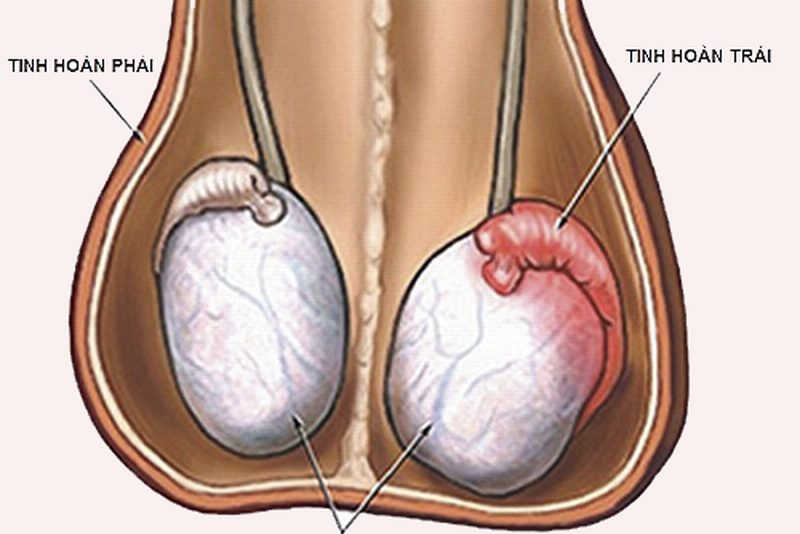 Tuyến tiền liệt là một tuyến sinh dục đặc biệt chỉ có ở nam giới, nó nằm ở gần phía cổ của bàng quang, nó bao quanh khu vực niệu đạo