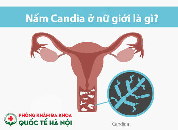 Bệnh nhiễm nấm Candida ở nữ giới thực chất là gì? Nguyên nhân biểu hiện và cách điều trị của căn bệnh này ra sao?