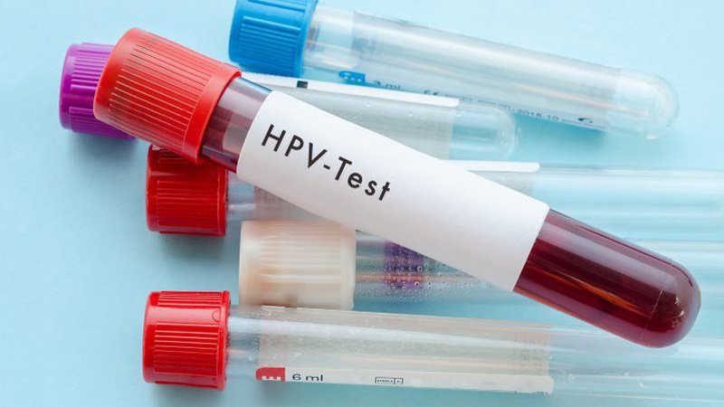 Xét nghiệm type HPV- PCR