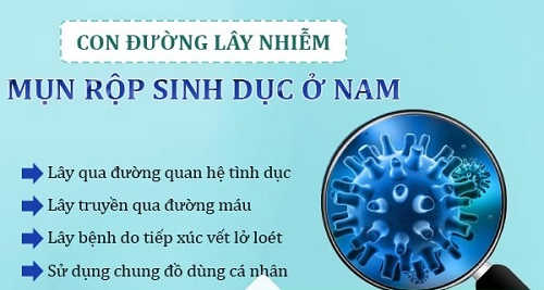 mun-rop-sinh-duc-nam-lay-nhiem-the-nao