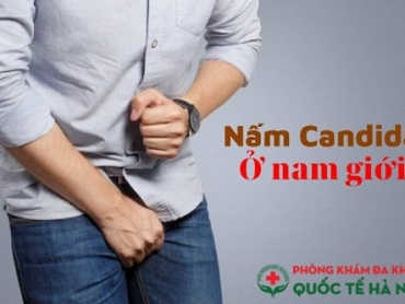 nam-candida-o-nam-gioi-nhung-thong-tin-quan-trong-can-biet