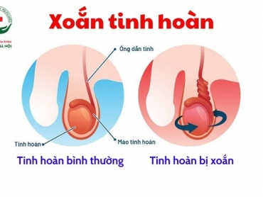 xoan-tinh-hoan-va-nhung-thong-tin-nam-gioi-can-biet